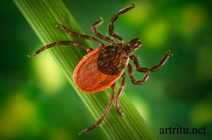 lyme-disease Артрит при Болезни Лайма (боррелиозный артрит)