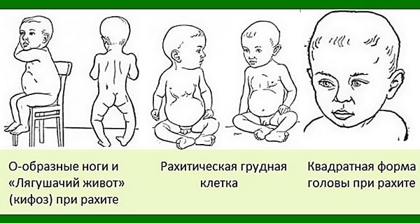 Витамин д3: применение, польза, вред, аналоги и отзывы Нарушения от недостатка Д3