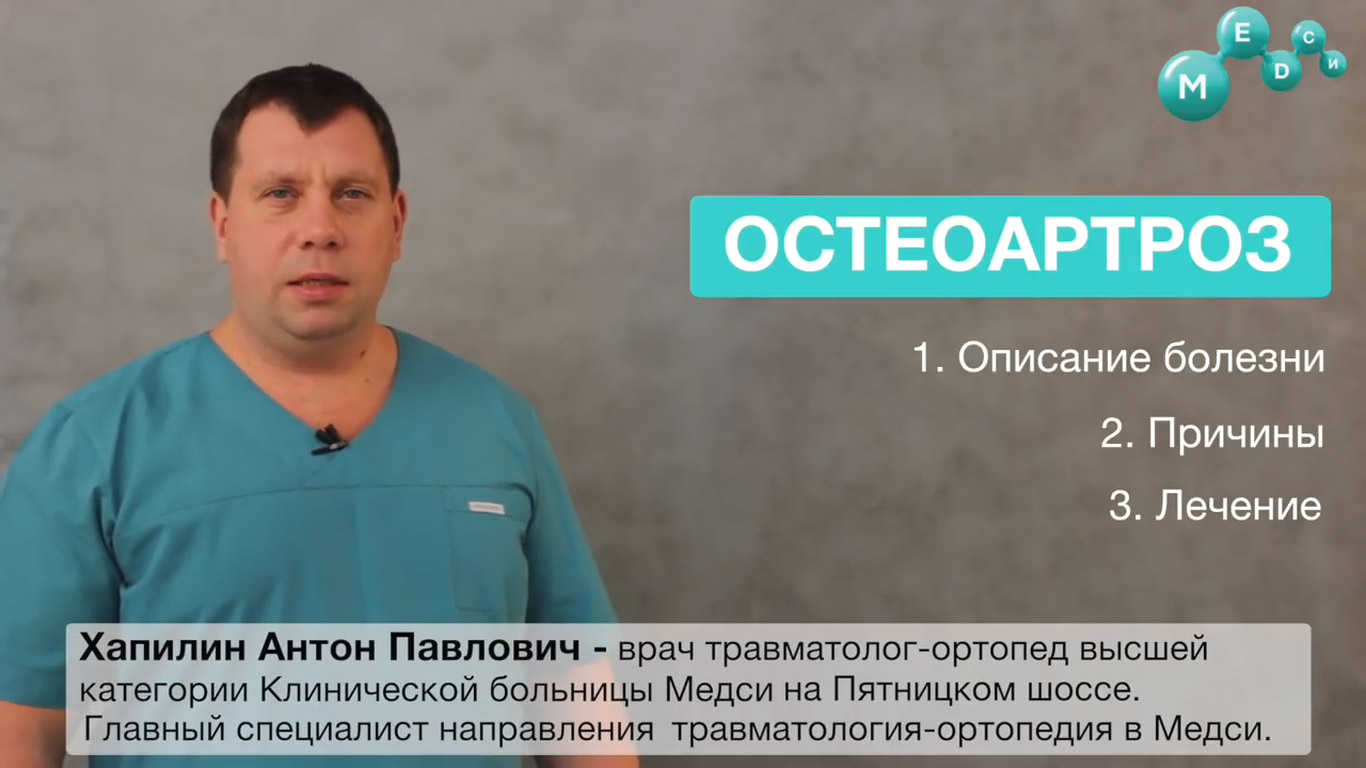 Остеоартроз суставов