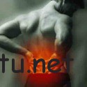 Остеохондропатия апофизов тел позвонков Диагностика юношеского кифоза