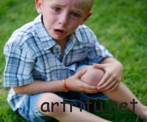 osteochondropathy4