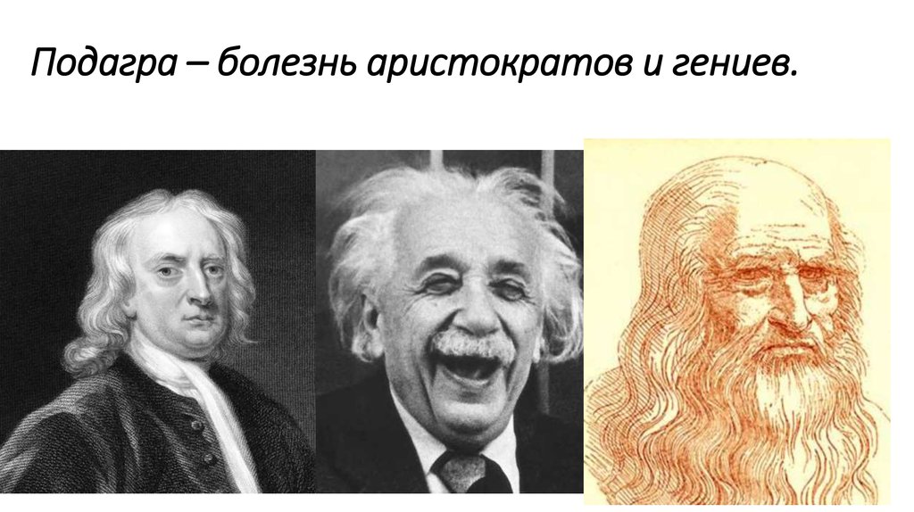 Подагра у знаменитостей