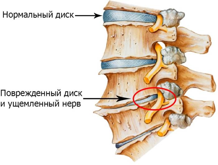 Поврежденный диск
