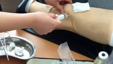 пункция сустава
