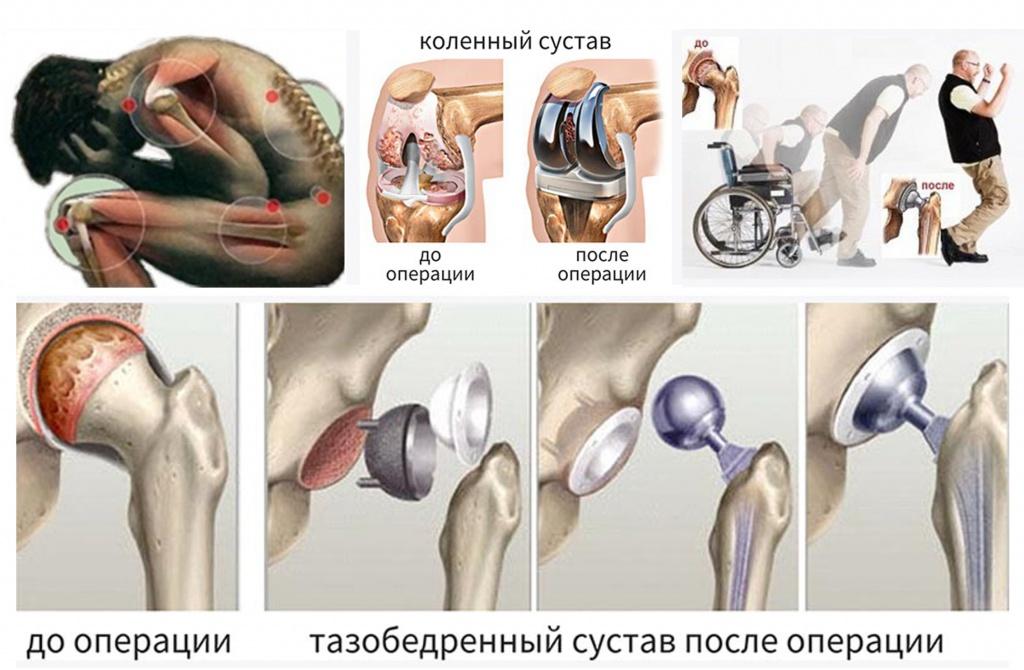 Работоспособность конечности