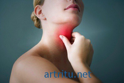 rheumatism7 Причины острой ревматической лихорадки