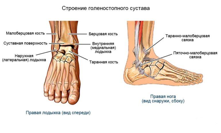 Воспаление околосуставных тканей