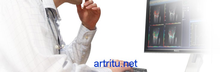 Прогноз синовита Прогноз синовита