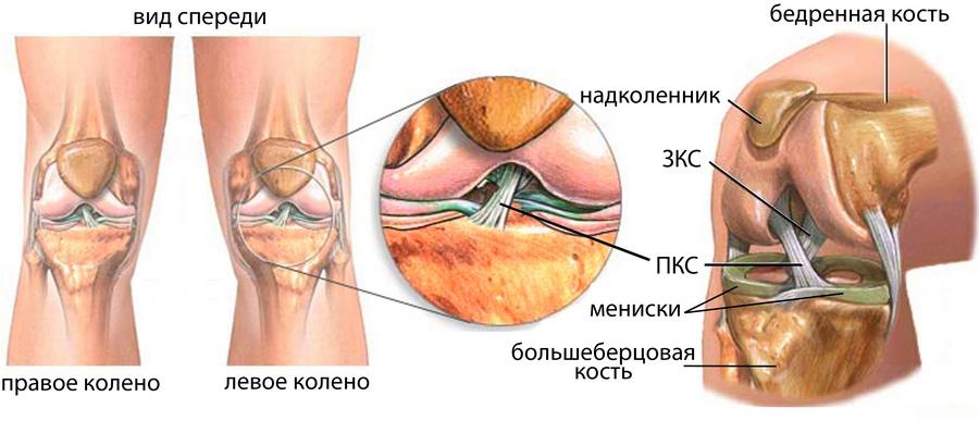 Травма связки коленного сустава