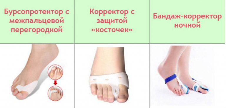 Виды фиксаторов