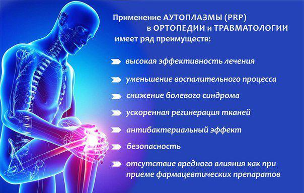 Внутрисуставные уколы