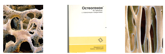 Воздействие остеогенона на восстановление кости