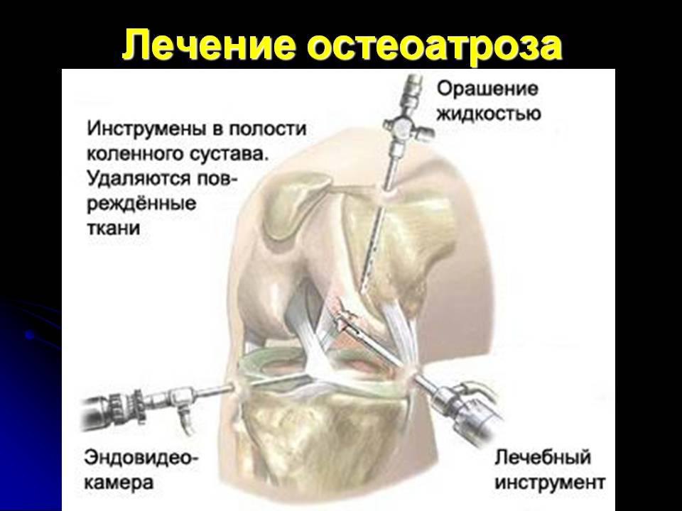Хирургическое лечение