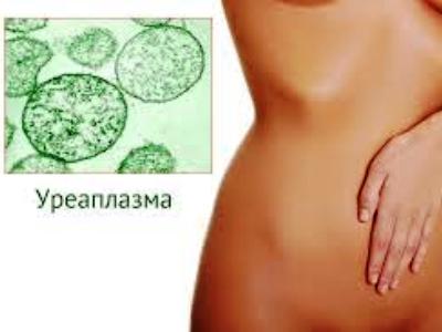 Уреаплазма
