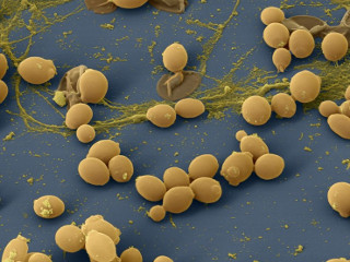 Грибок рода Candida — возбудитель вагинального кандидоза