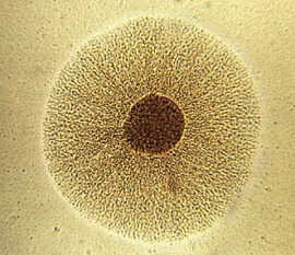 Mycoplasma hominis