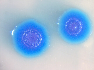 Mycoplasma genitalium