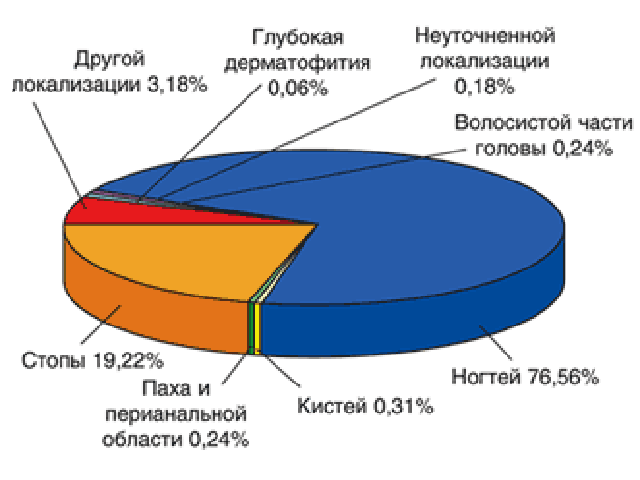 Грибок дерматофит в паху и других областях у женщин