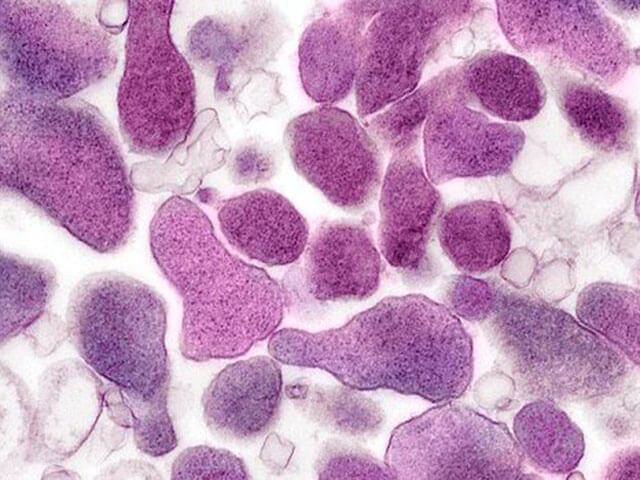 Mycoplasma genitalium что это за микроорганизм