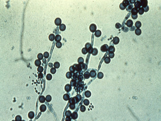 Как выглядит Candida albicans