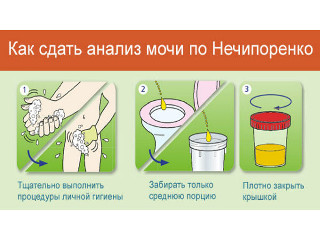 Как правильно сдать анализ мочи по Нечипоренко