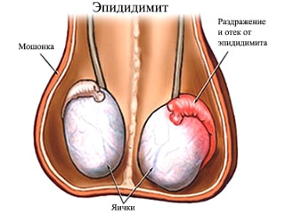 Почему болит яйцо правое