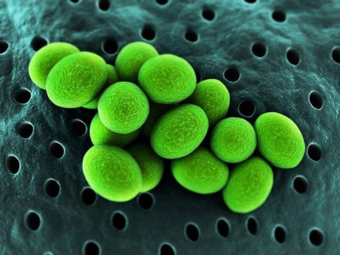 Ureaplasma urealyticum