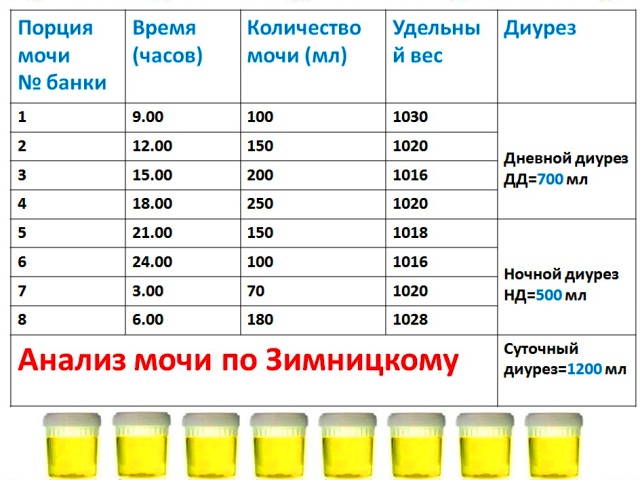 Анализ мочи по Зимницкому (схема)