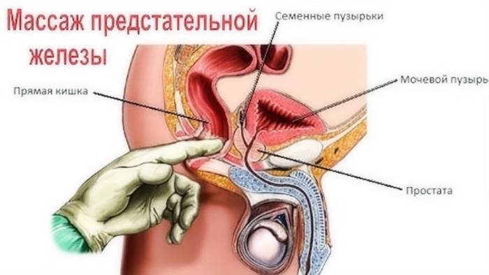 Массаж предстательной железы