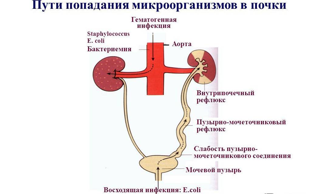 Пути попадания микроорганизмов в почки