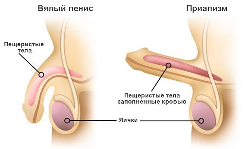 Половой член при приапизме и в обычном состоянии