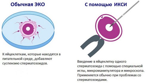 ЭКО: что за процедура и как выбрать клинику