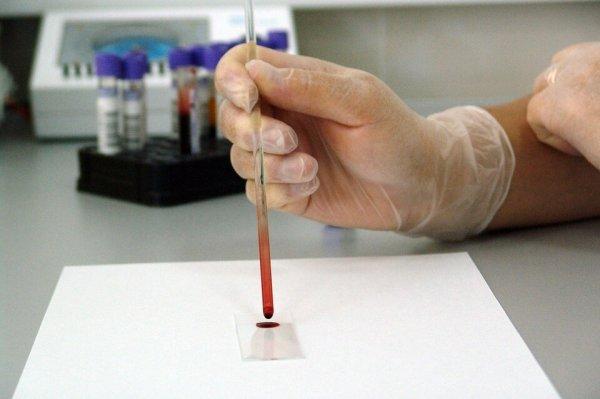 Определение заболеваний при помощи скрининга
