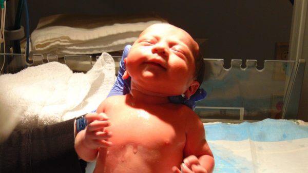 операционный метод избавления от водянки головного мозга у малыша